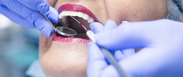 Best Knocked-Out Tooth Emergency  in Johnston, IA